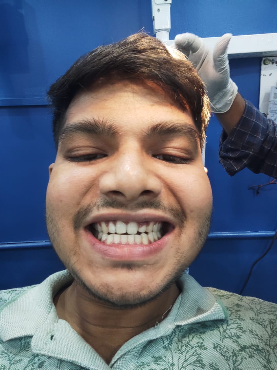 After Tooth Extraction